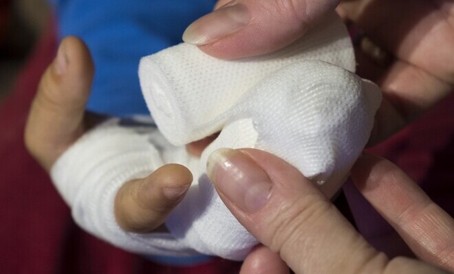 A la fecha, se cuentan 312 víctimas por quemaduras con este químico en el país; 105 son menores de edad.