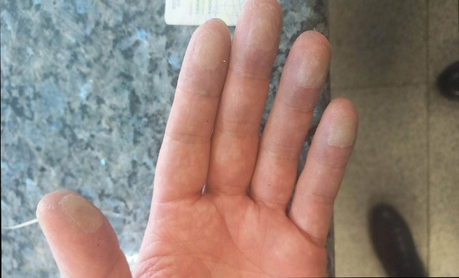 Capturado por usar huellas de látex 