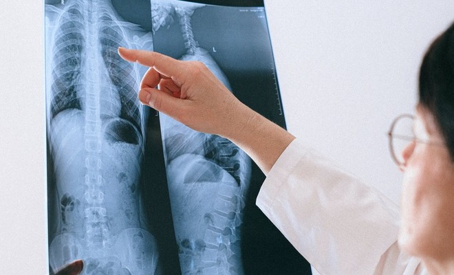 se puede complicar si las bacterias ingresan al torrente sanguíneo, provocando insuficiencia orgánica